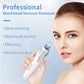 Blackhead Suction Instrument, Electric Blackhead Suction Artifact, Blackhead Removal Instrument, Home Use Beauty Instrument For Sucking Blackheads And Acne - The Peppermint Room