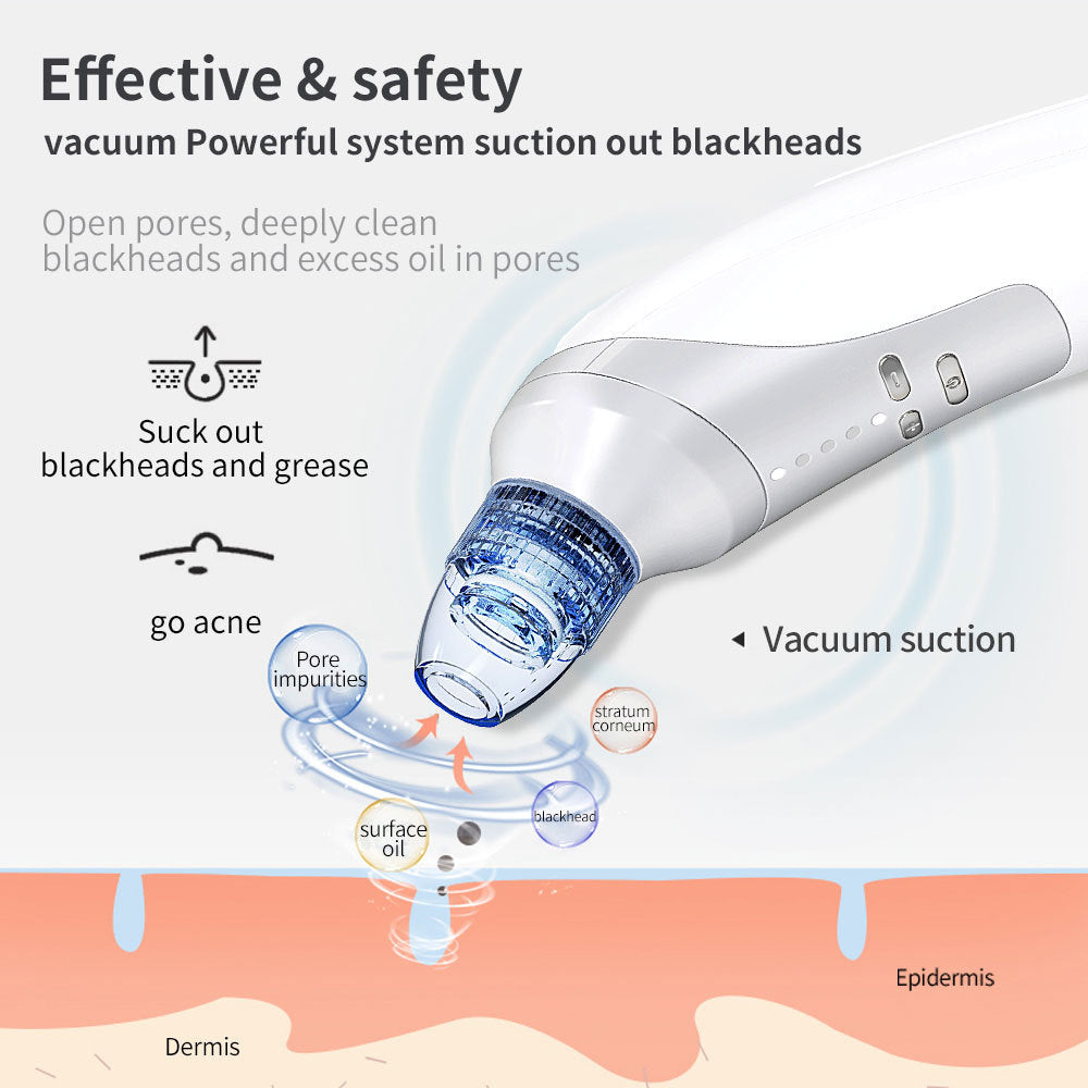 Blackhead Suction Instrument, Electric Blackhead Suction Artifact, Blackhead Removal Instrument, Home Use Beauty Instrument For Sucking Blackheads And Acne - The Peppermint Room