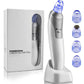 Blackhead Suction Instrument, Electric Blackhead Suction Artifact, Blackhead Removal Instrument, Home Use Beauty Instrument For Sucking Blackheads And Acne - The Peppermint Room