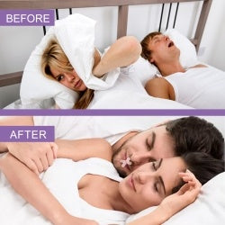 OUHOE Anti-Snoring Sleep Tape – Mouth Breathing Aid