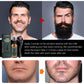 Moustache Spray Set Moisturizing Spray Facial Hair Treatment Boosting Beard Growth Thickening Liquid - The Peppermint Room