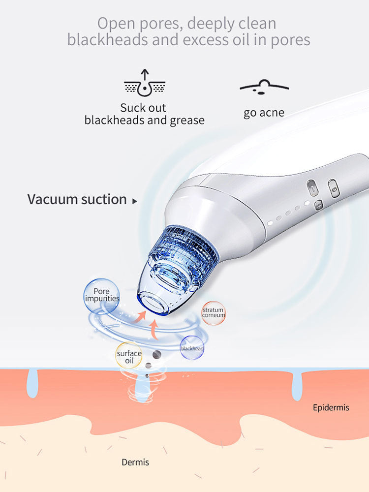 Blackhead Suction Instrument, Electric Blackhead Suction Artifact, Blackhead Removal Instrument, Home Use Beauty Instrument For Sucking Blackheads And Acne - The Peppermint Room